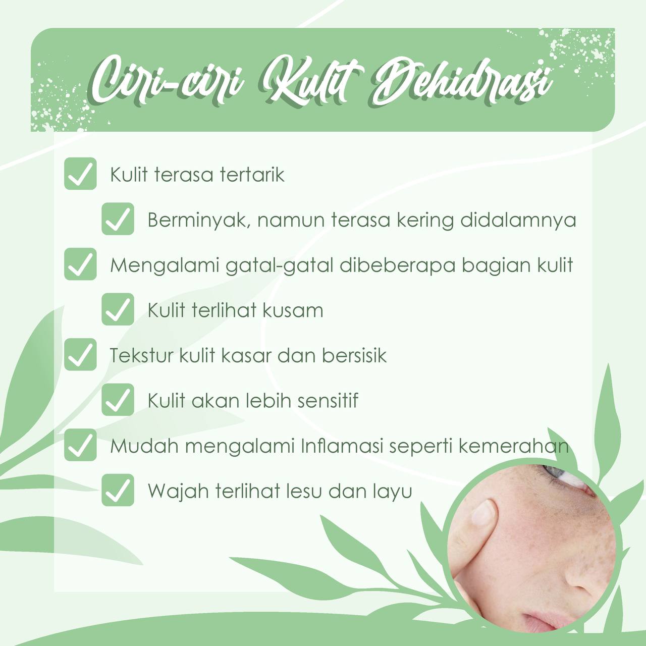 Beberapa hal yang harus kita ketahui mengenai kulit dehidrasi