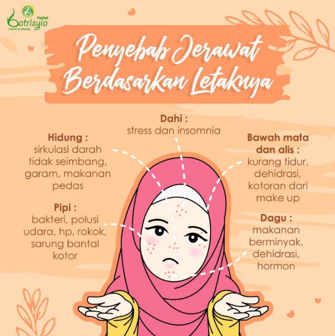 penyebab dan letak jerawat ada artinya