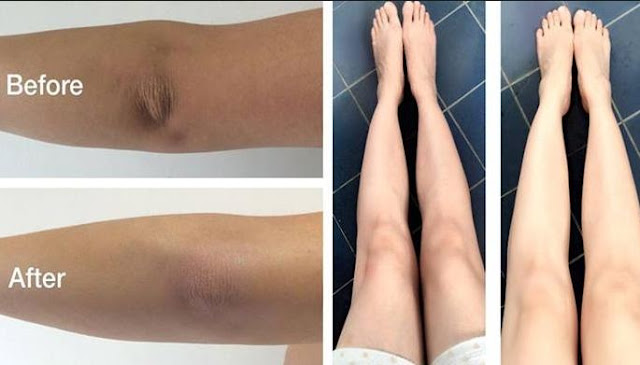 cerahkan siku dan lutut dengan Batrisyia Body Cream