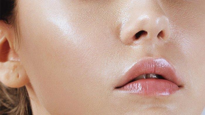 penyebab terjadinya kulit berminyak semakin parah