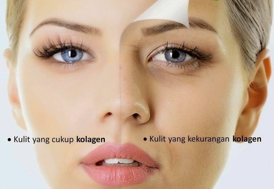 tanda kamu kekurangan kolagen pad kulitmu