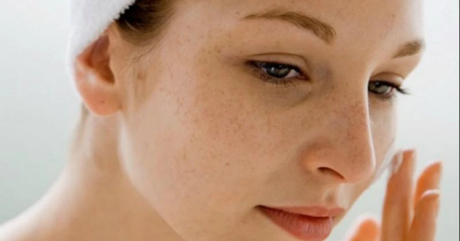 skincare untuk mengatasi flek hitam