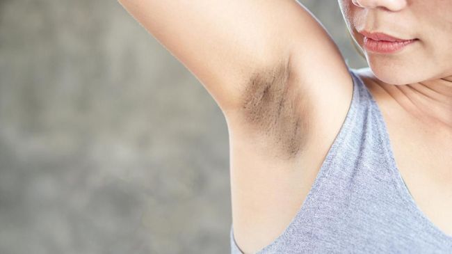 cara ampuh atasi ketiak hitam