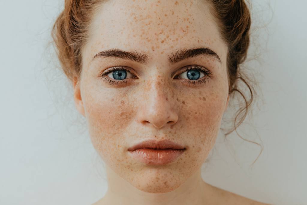 skincare alami atasi flek hitam