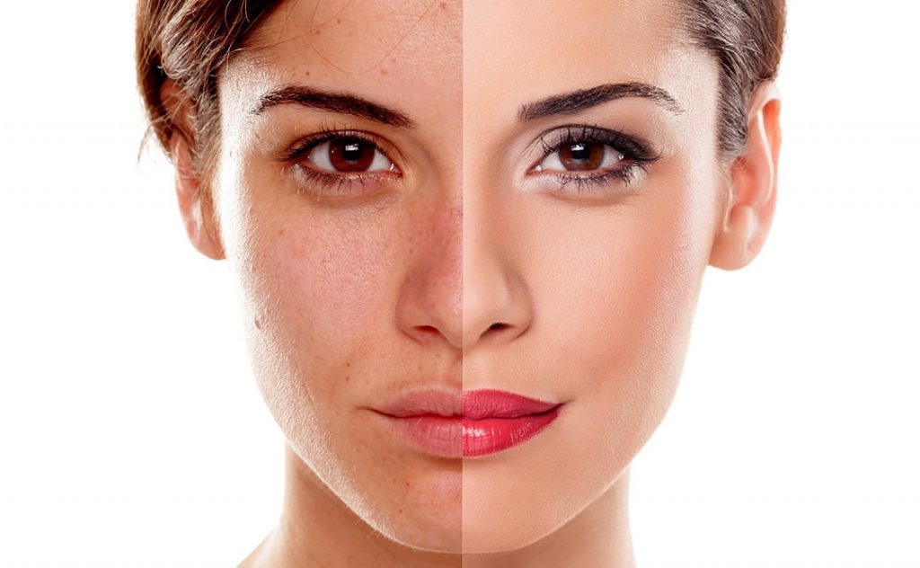 skincare Batrisyia untuk mengatasi flek hitam