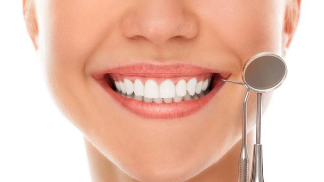 langkah untuk memutihkan gigi secara alami