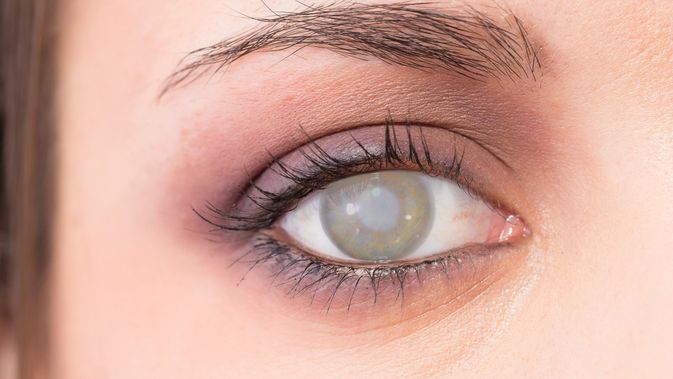 Jual Tetes Mata untuk katarak