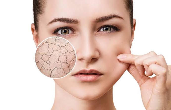 kulit kering atasi dengan skincare ini