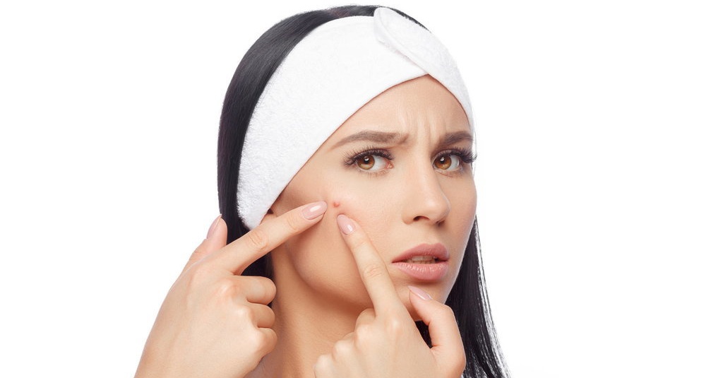 wajib tau tanda skin purging