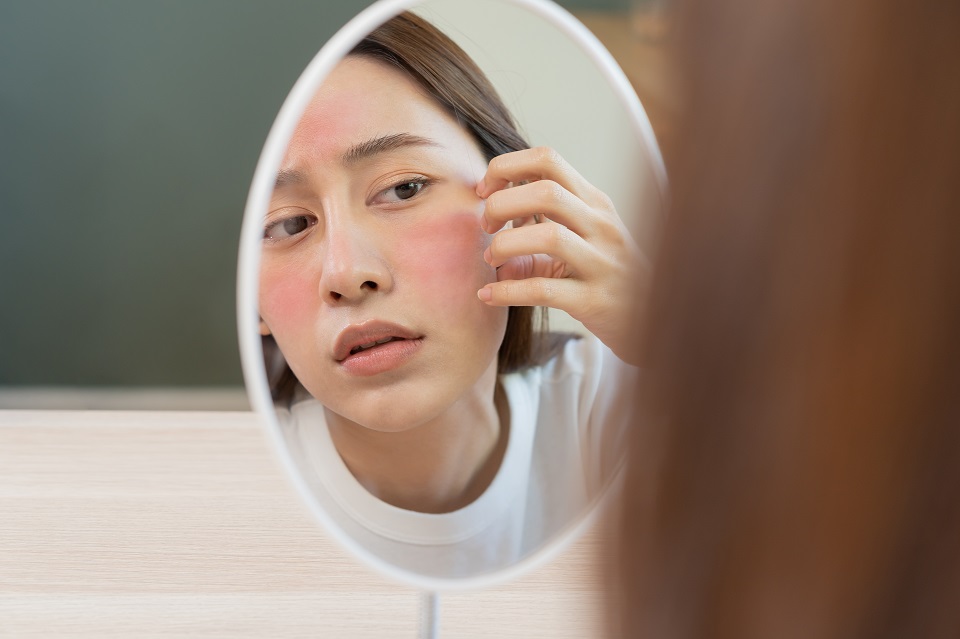 skincare alami atasi masalah kulit kering