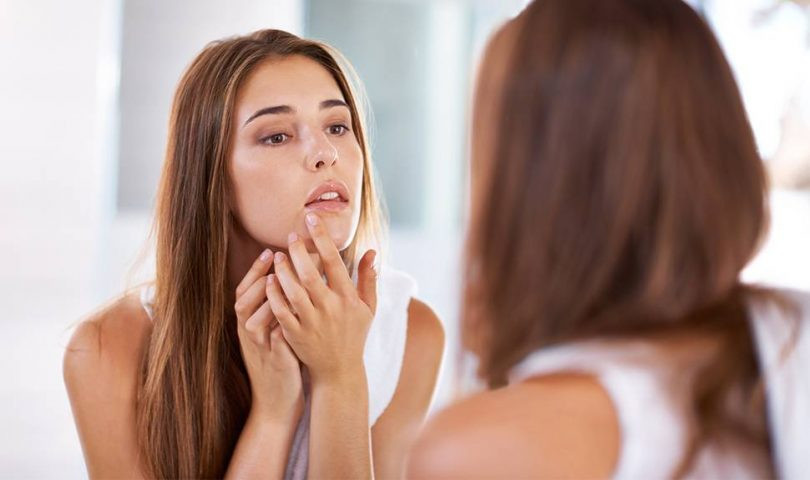 cara efektif mengatasi skin purging