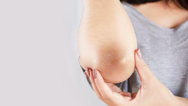 penyebab dan cara mengatasi siku dan lutut hitam