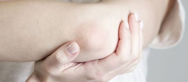 produk untuk memutihkan siku dan lutut