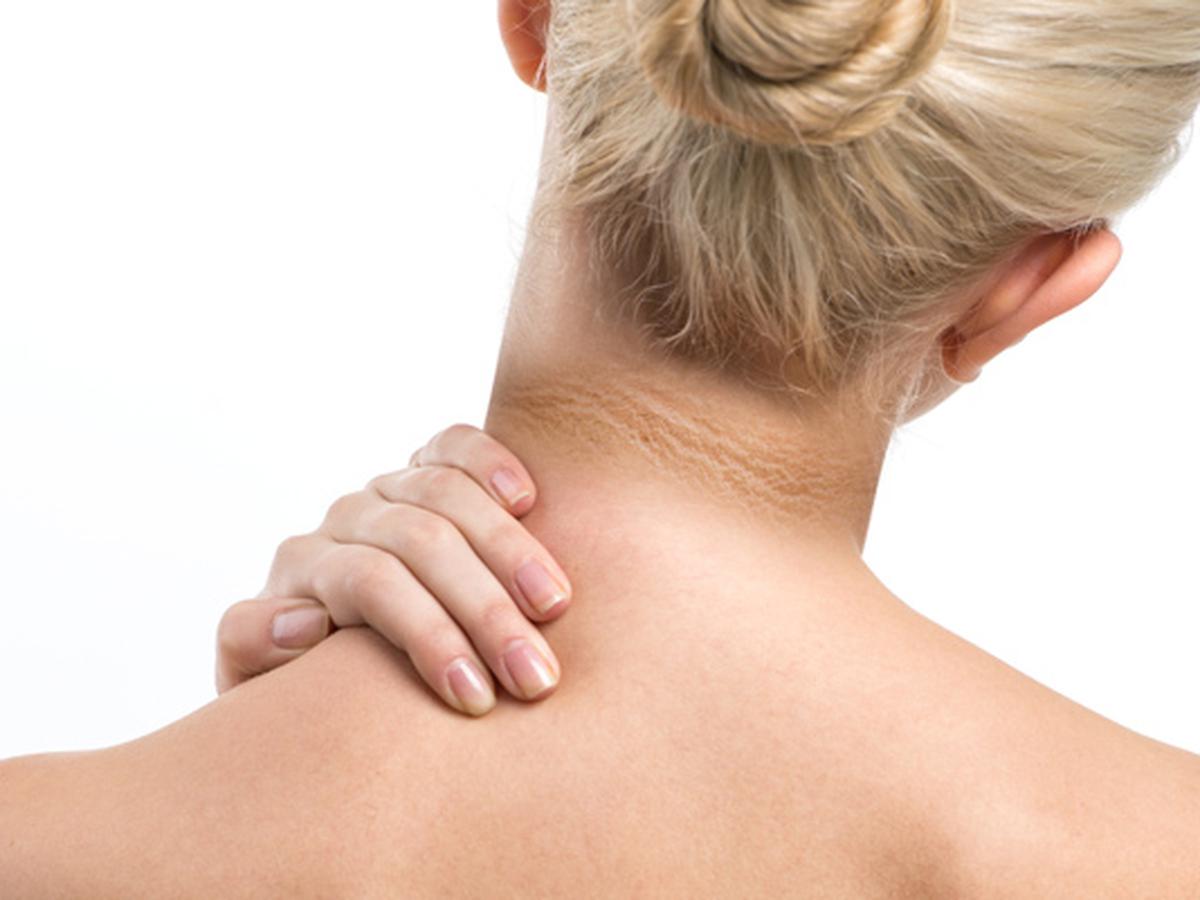 penyebab dan cara mengatasi leher yang menghitam