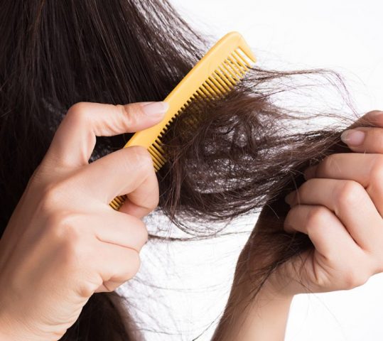 5 Tanda Rambut Rapuh yang Perlu Disadari