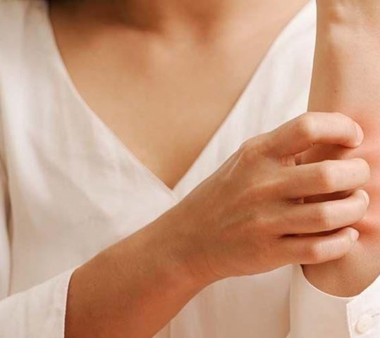 Apa Itu Hypoallergenic?