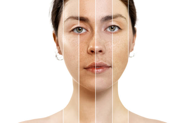 rekomendasi skincare untuk eksfoliasi